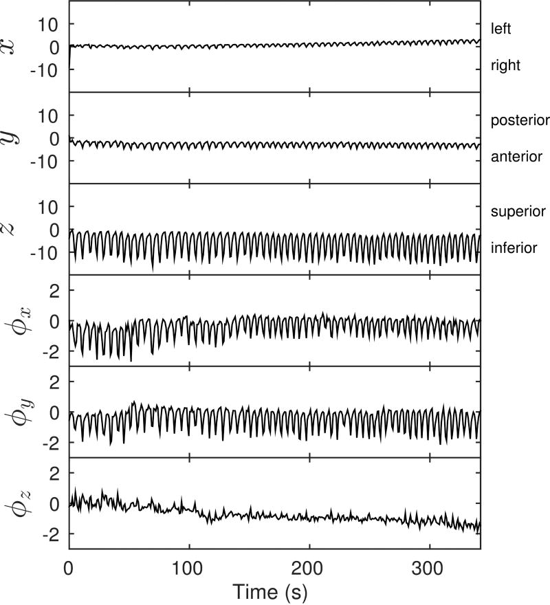 FIG. 4