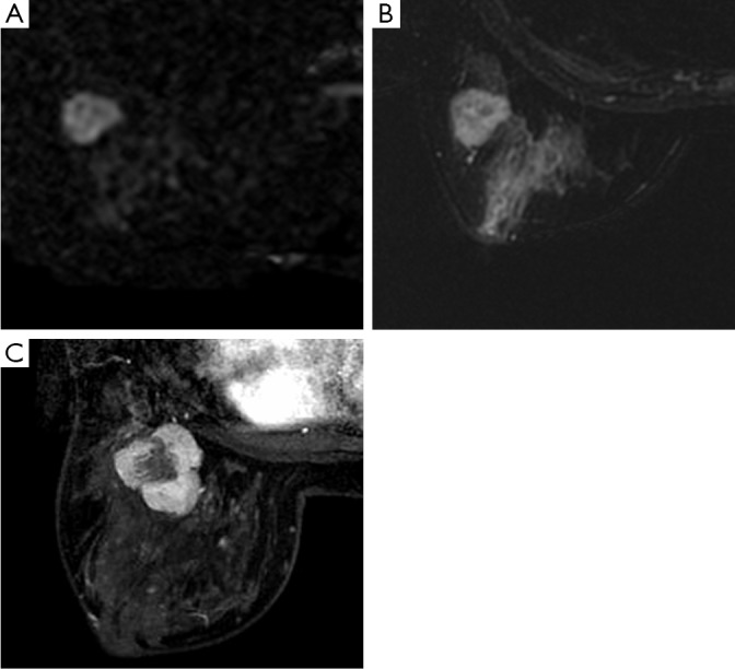 Figure 15