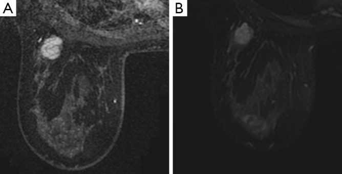 Figure 43