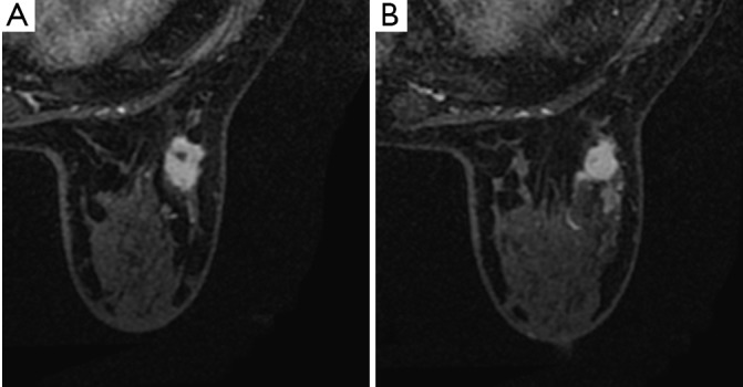 Figure 19