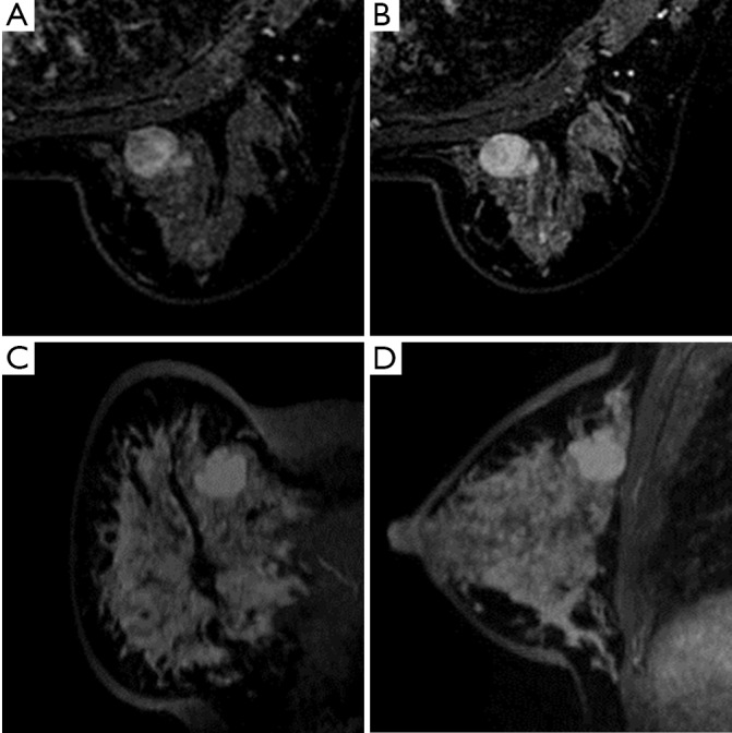 Figure 37