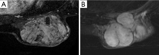 Figure 45