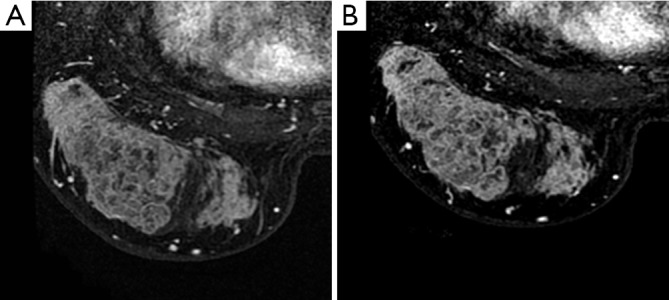 Figure 31