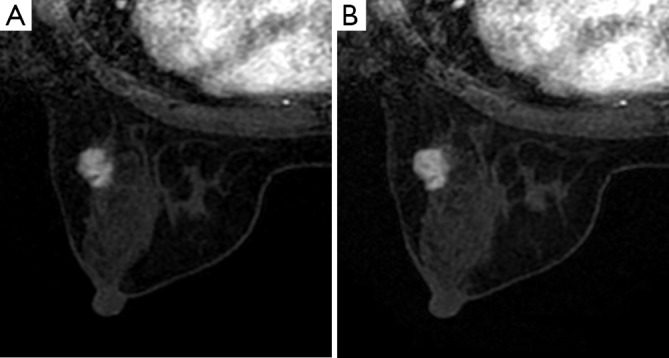 Figure 30