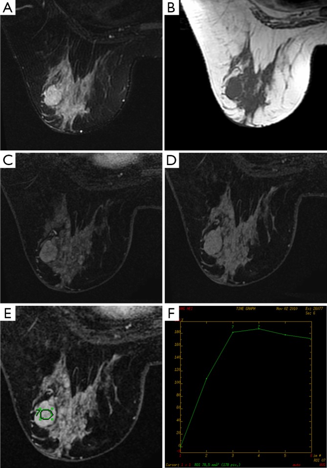 Figure 49