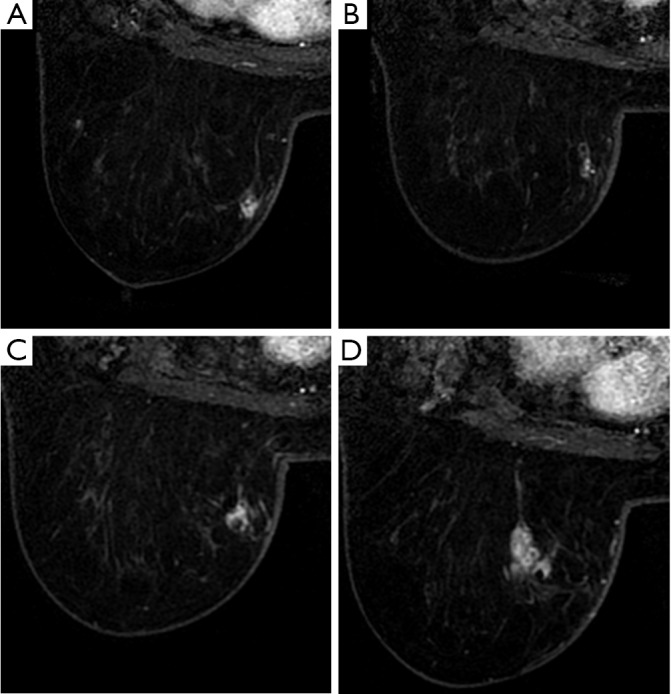 Figure 20