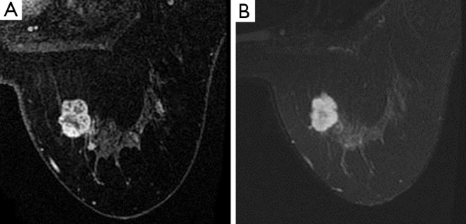 Figure 46