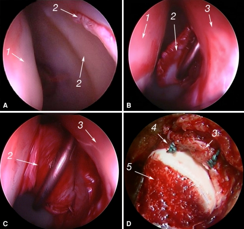 Fig. 4A–D