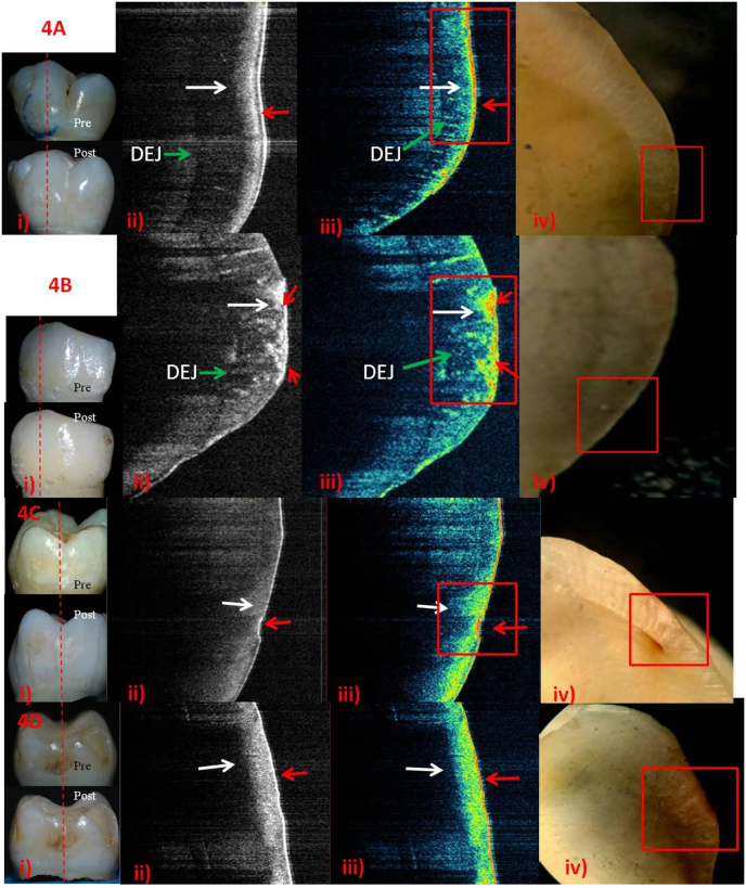 Fig. 4