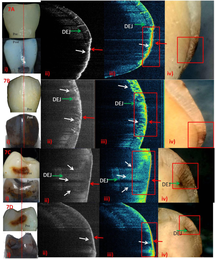 Fig. 7