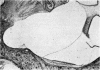 194