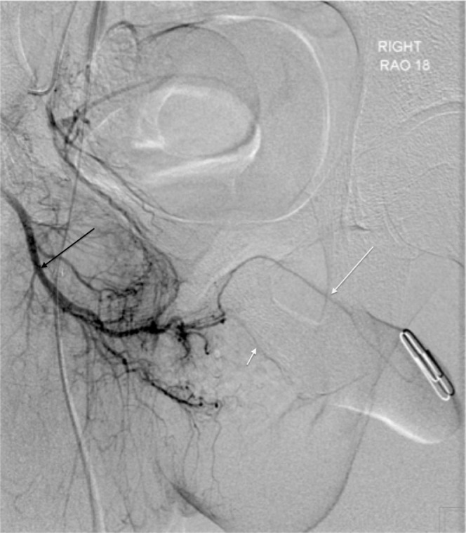 Figure 14