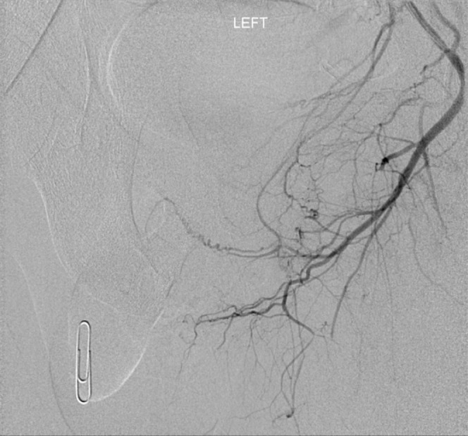 Figure 15