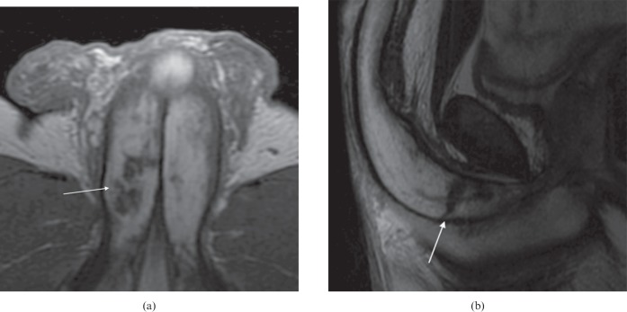 Figure 16