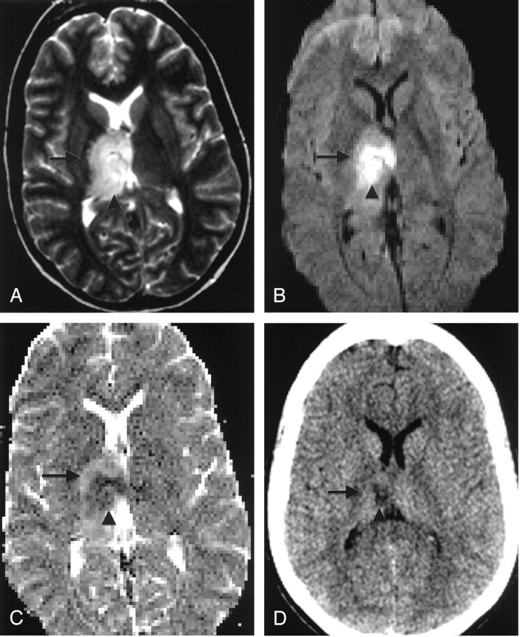 Fig 4.