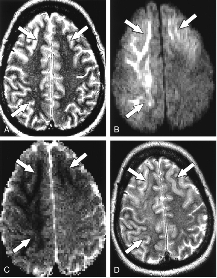 Fig 2.