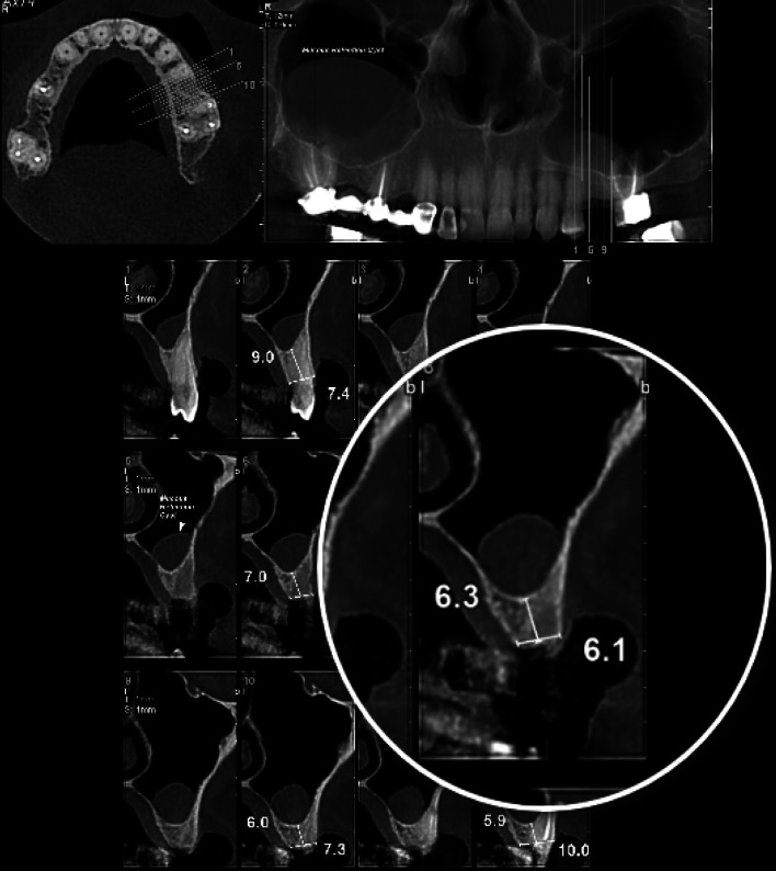 Fig. 4