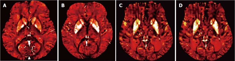 Figure 20