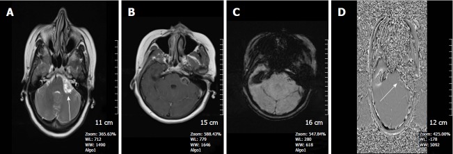 Figure 17