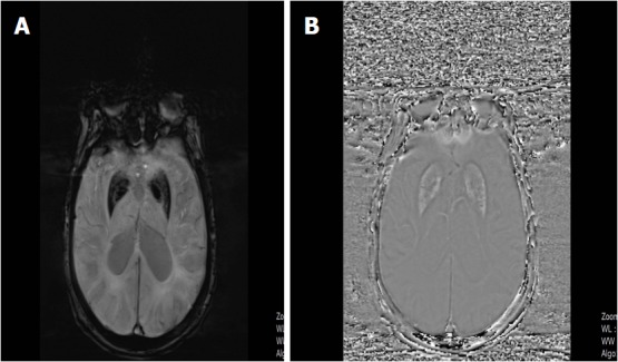 Figure 15