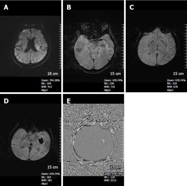 Figure 14