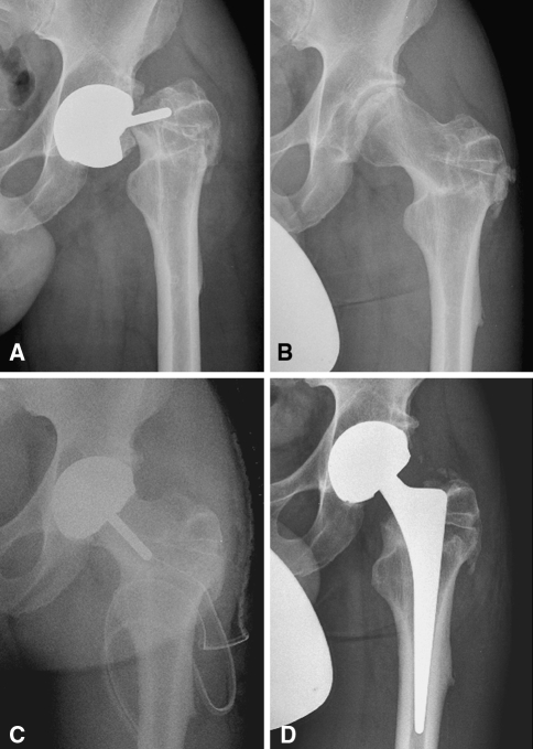 Fig. 1A–D