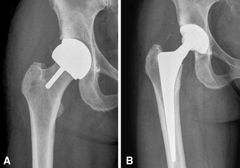 Fig. 2A–B