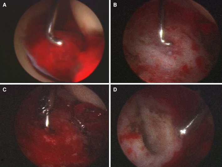 Fig. 3A–D