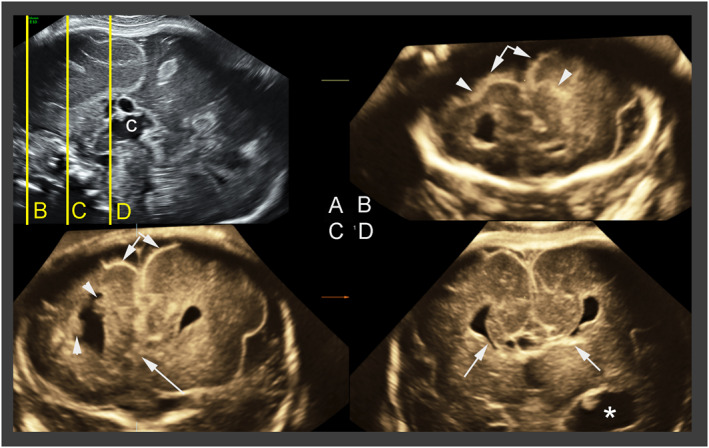 FIGURE 1