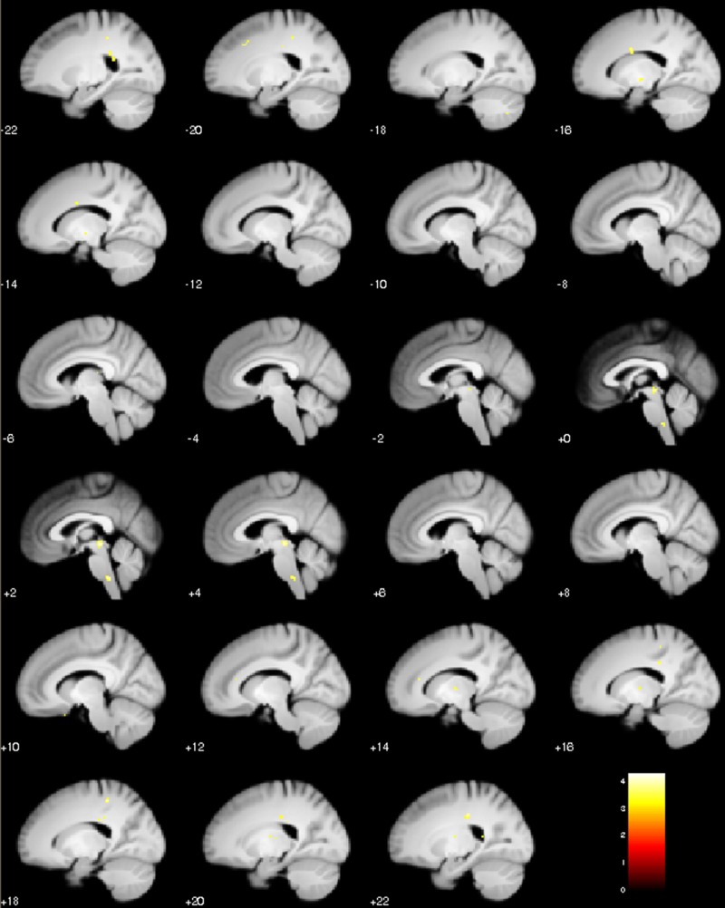 Figure 4—figure supplement 1.