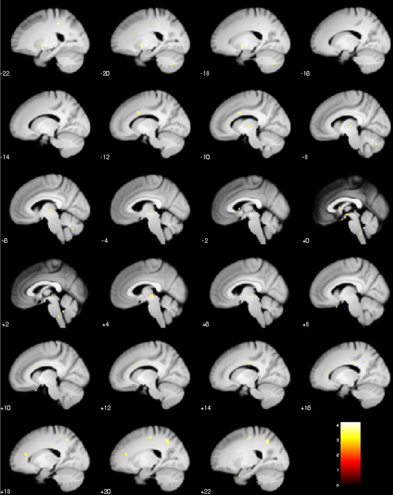 Figure 4—figure supplement 3.