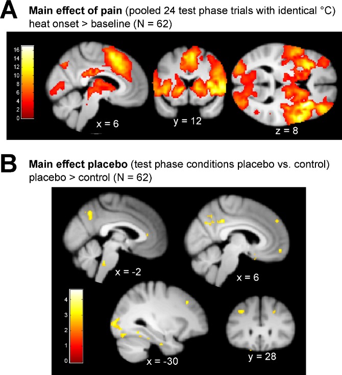 Figure 4—figure supplement 5.