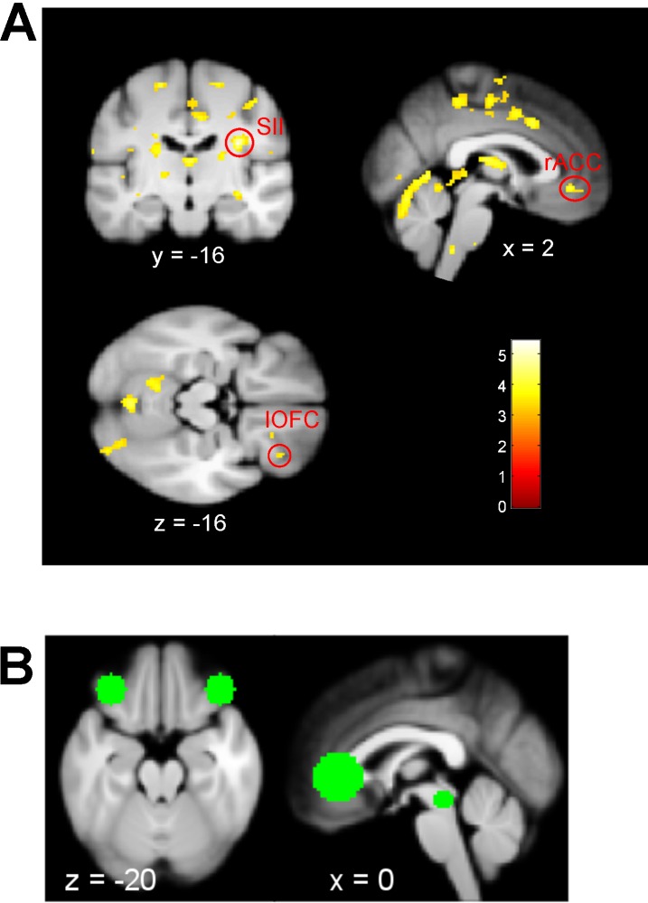 Figure 4—figure supplement 4.