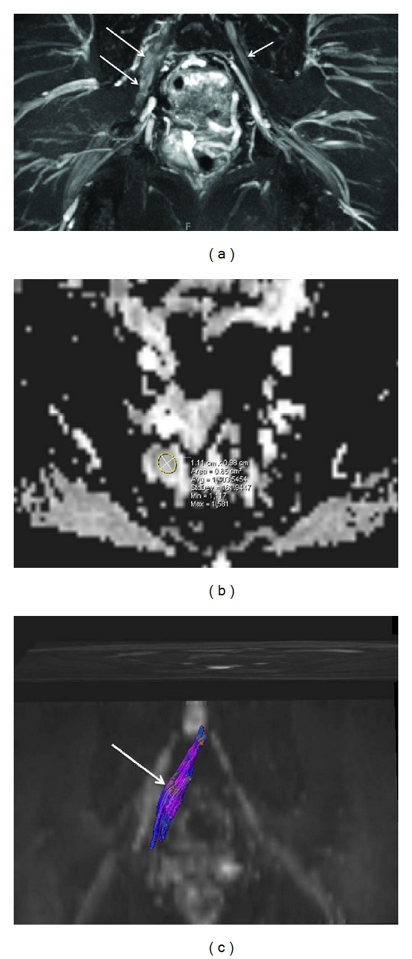 Figure 9