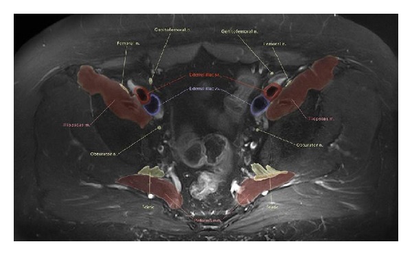 Figure 14