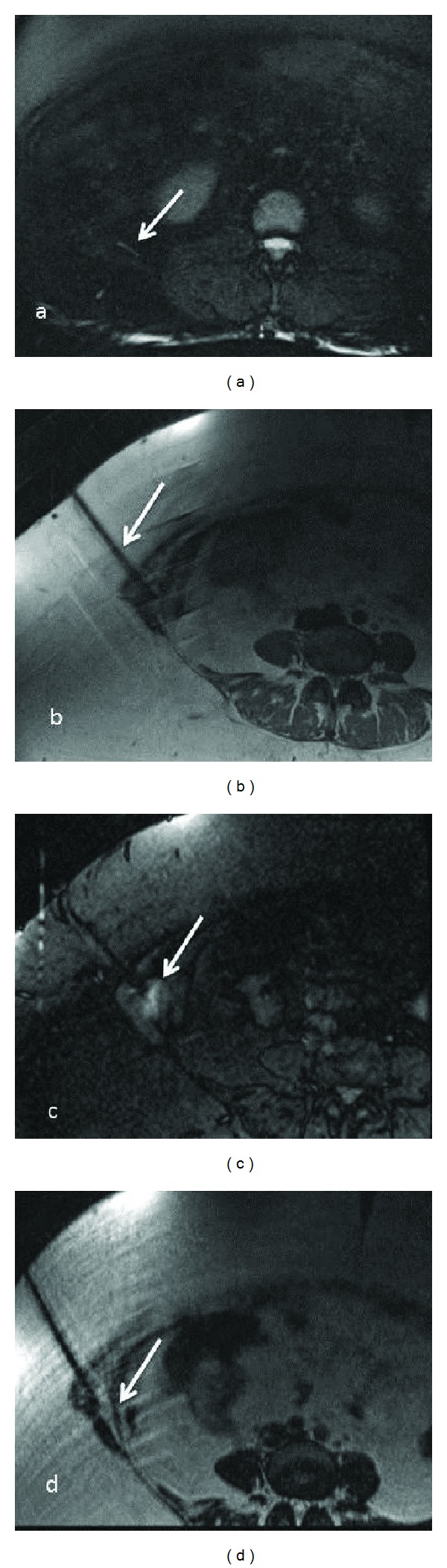 Figure 13