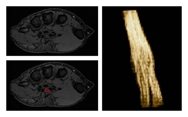 Figure 15