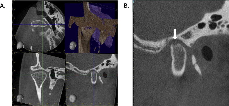 Figure 3