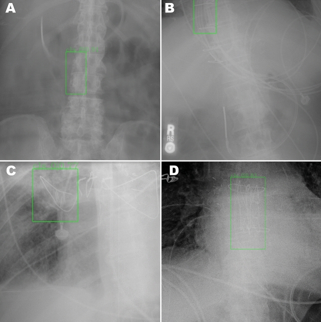 Fig. 4