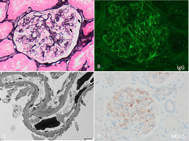 Figure 1