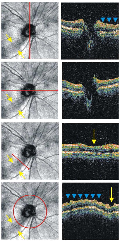 Figure 19