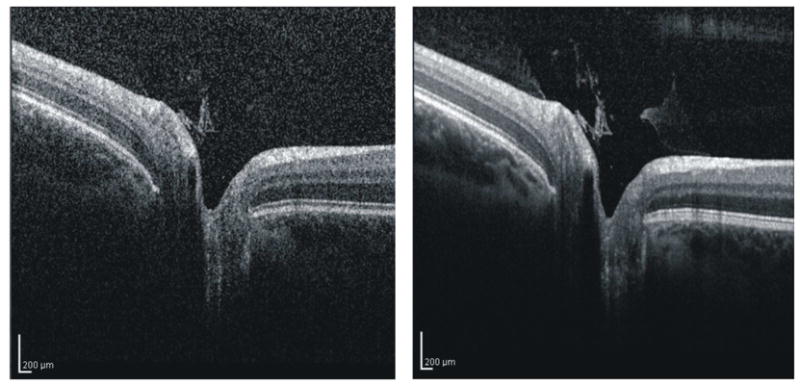 Figure 22