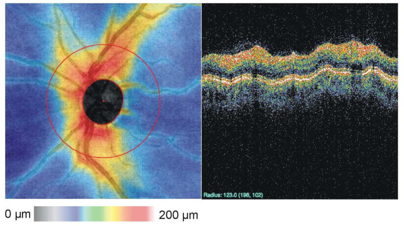 Figure 20