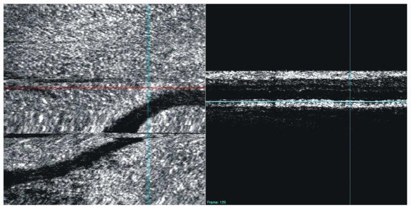 Figure 25