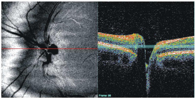 Figure 23