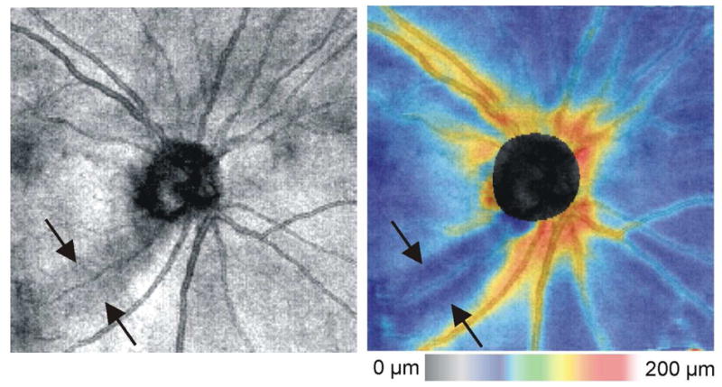 Figure 15