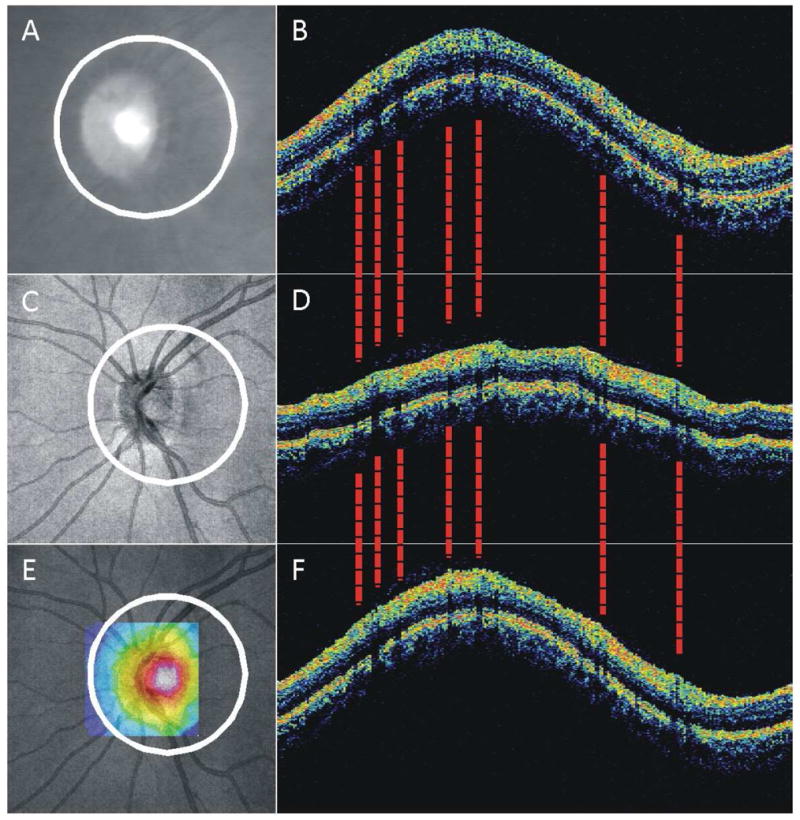 Figure 26