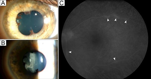 Figure 2: