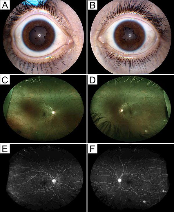 Figure 1: