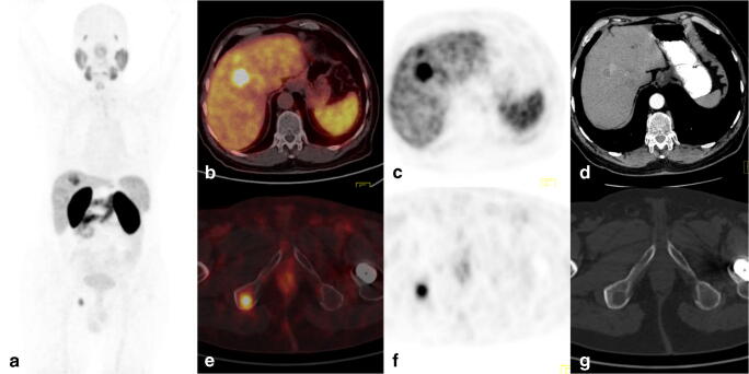 Fig. 1